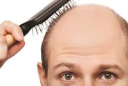 کدام ویتامین‌ها از ریزش مو جلوگیری می‌کنند؟