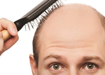 کدام ویتامین‌ها از ریزش مو جلوگیری می‌کنند؟